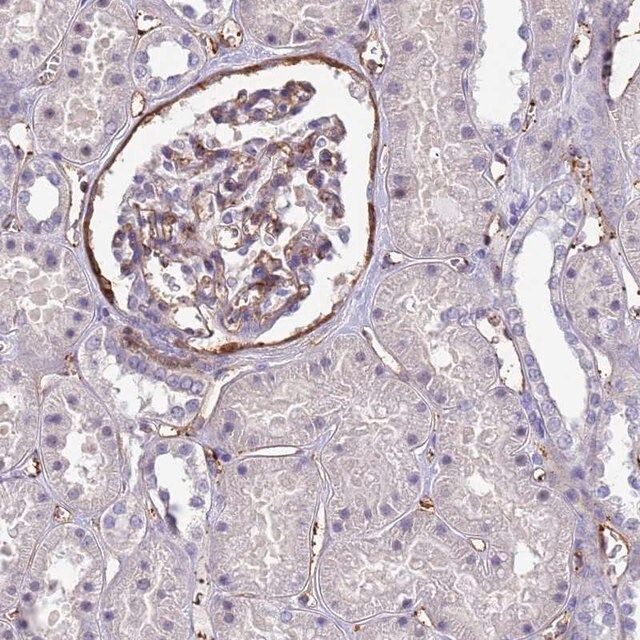 Anti-EHD2 antibody produced in rabbit