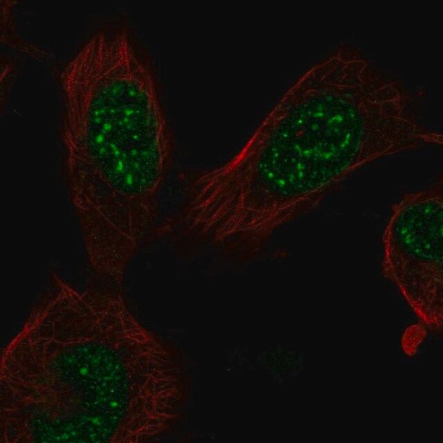 Anti-E2F7 antibody produced in rabbit