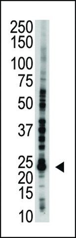 ANTI-E2EPF(C-TERMINAL) antibody produced in rabbit