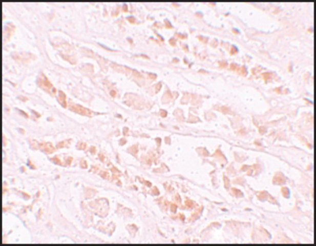 Anti-EFCAB4B antibody produced in rabbit