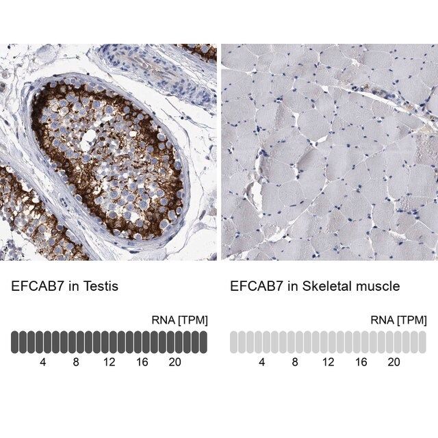 Anti-EFCAB7 antibody produced in rabbit