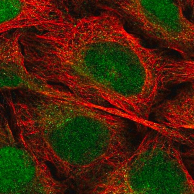 Anti-EEF1E1 antibody produced in rabbit