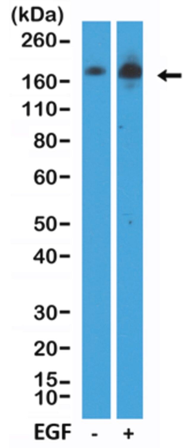 Anti-EGFR (phospho Y1068) Rabbit Monoclonal Antibody