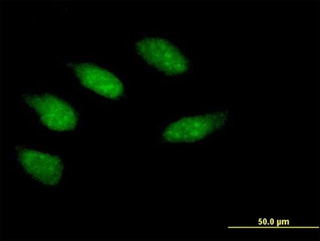 Anti-EGR2 antibody produced in mouse