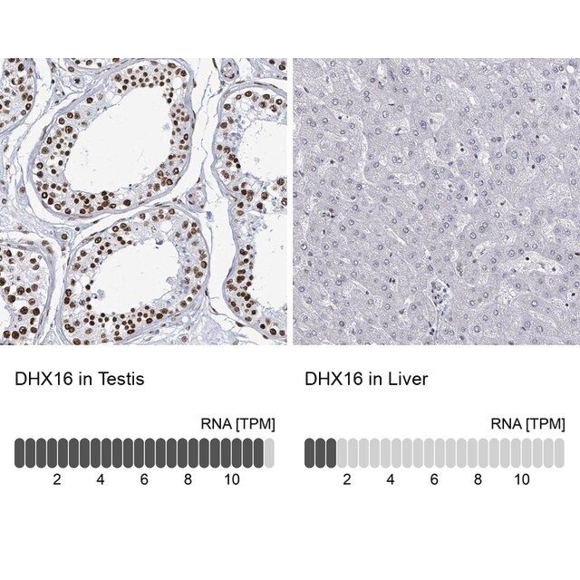 Anti-DHX16 antibody produced in rabbit