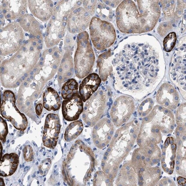 Anti-DHX58 antibody produced in rabbit