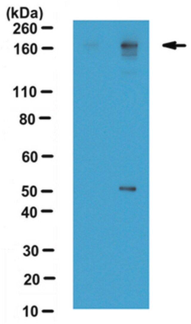 Anti-dimethyl-BAF155 Antibody (Arg1064, asymetrically di-methylated)