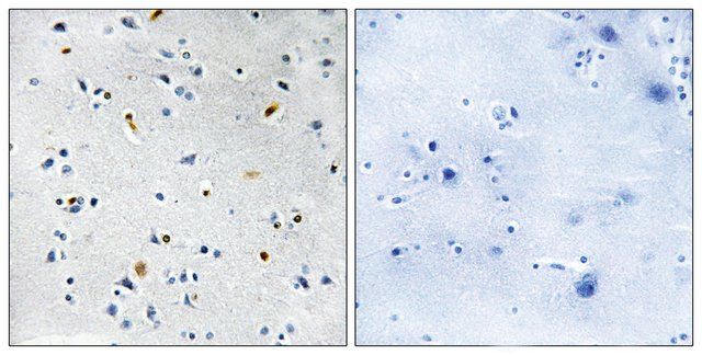 Anti-DIL-2 antibody produced in rabbit