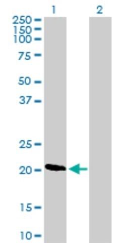 Anti-DIRAS1 antibody produced in mouse