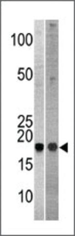 Anti-DIMT1 (C-term) antibody produced in rabbit