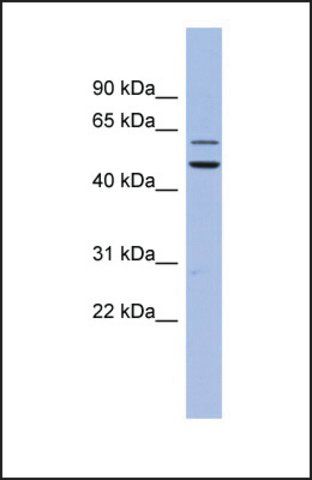 Anti-DKC1, (N-terminal) antibody produced in rabbit