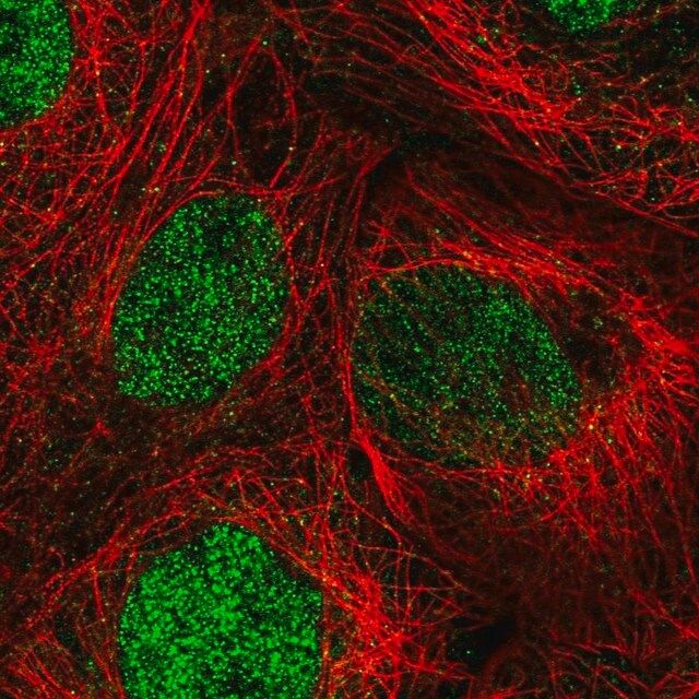 Anti-DIS3 antibody produced in rabbit