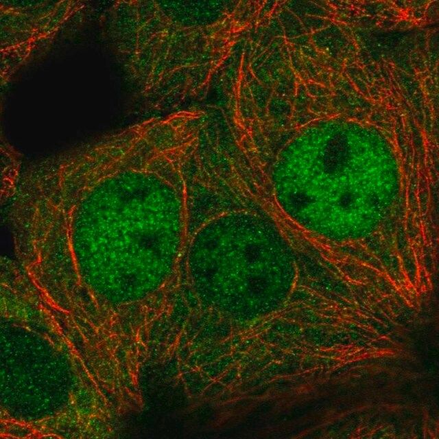 Anti-DIP2C antibody produced in rabbit