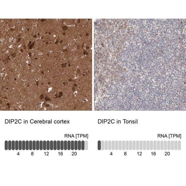 Anti-DIP2C antibody produced in rabbit