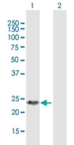 Anti-DIRAS2 antibody produced in mouse