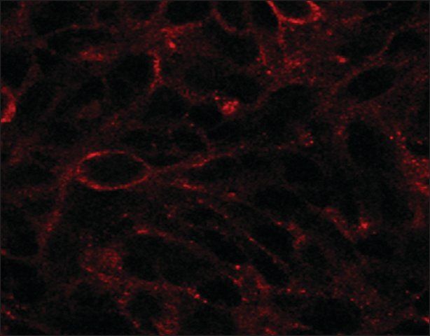 Anti-DISP1 (C-terminal) antibody produced in goat