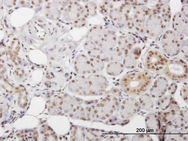 Anti-DKC1 antibody produced in mouse