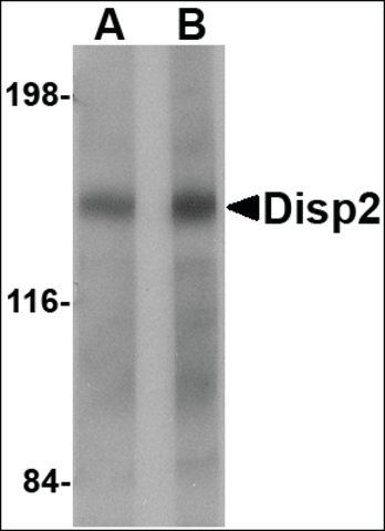 Anti-DISP2 antibody produced in rabbit