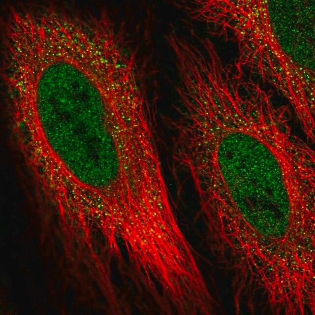 Anti-DIO2 antibody produced in rabbit