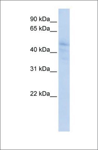 Anti-DLL3 antibody produced in rabbit