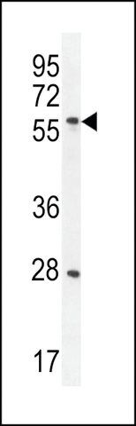 ANTI-DLK antibody produced in rabbit