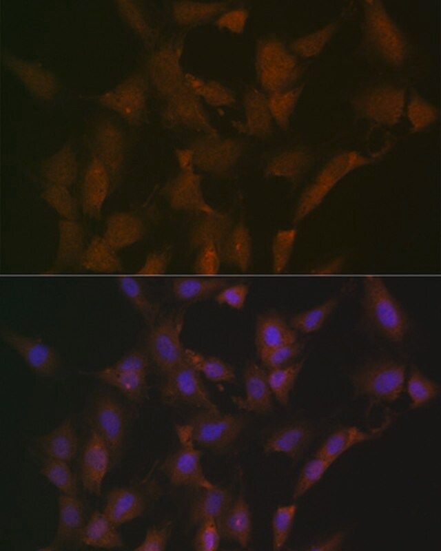 Anti-DISC1 antibody produced in rabbit