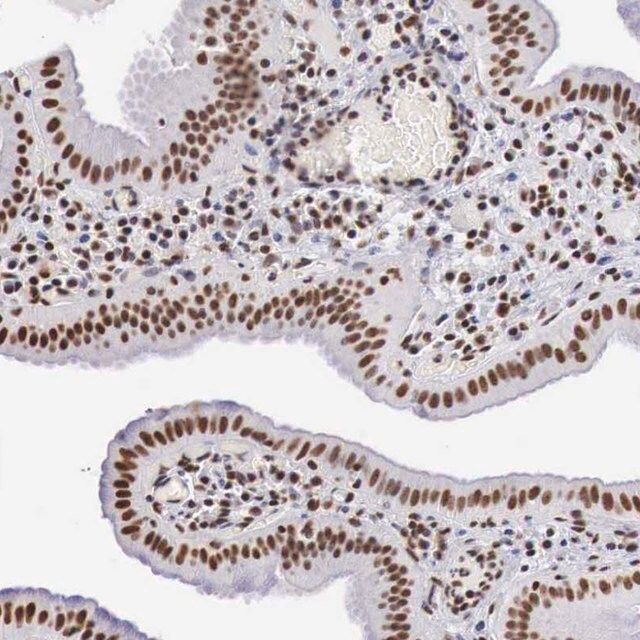 Anti-DKC1 antibody produced in rabbit