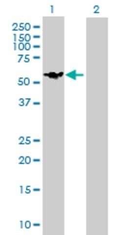 Anti-DIXDC1 antibody produced in mouse