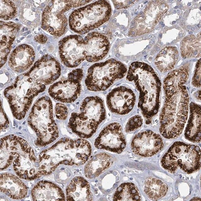 Anti-DISP1 antibody produced in rabbit