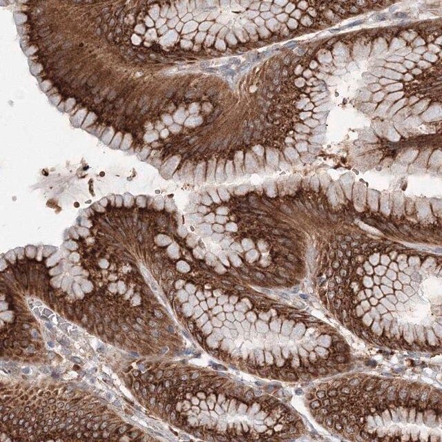 Anti-DIS3L2 antibody produced in rabbit