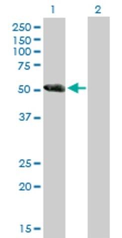 Anti-DKFZP779L1558 antibody produced in mouse