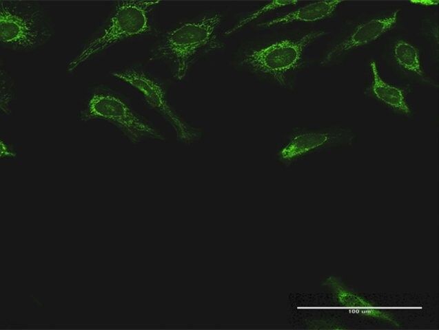 Anti-DLST antibody produced in rabbit