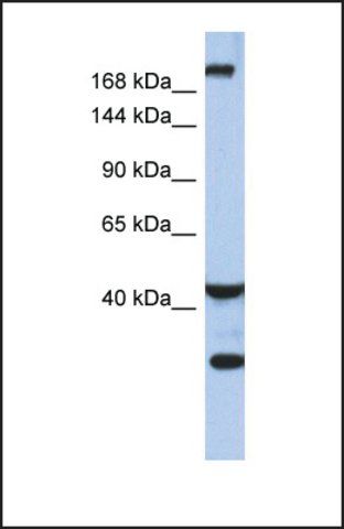 Anti-DISP1 antibody produced in rabbit