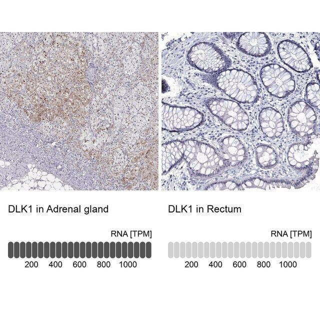 Anti-DLK1 antibody produced in rabbit