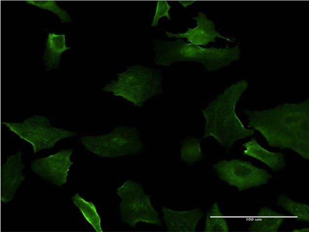 ANTI-DLX5 antibody produced in mouse