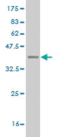 ANTI-DLX1 antibody produced in mouse