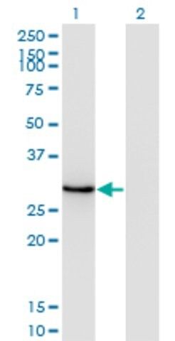 ANTI-DLX1 antibody produced in mouse