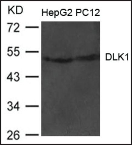 Anti-DLK1 antibody produced in rabbit