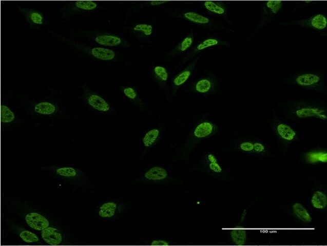 ANTI-DLX1 antibody produced in mouse