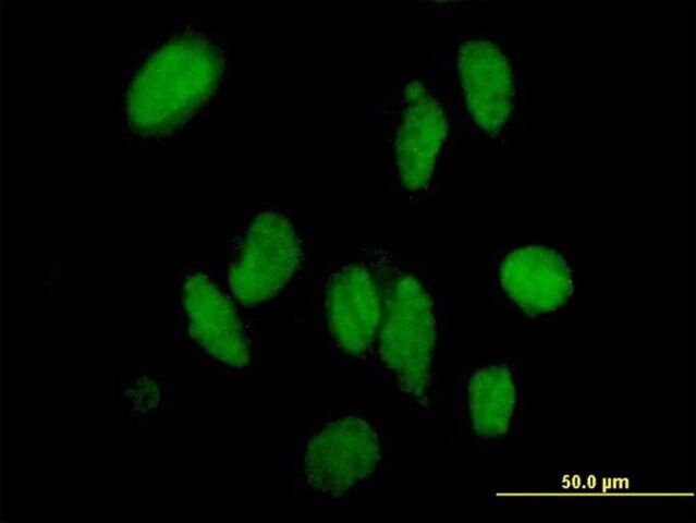 ANTI-DMAP1 antibody produced in mouse