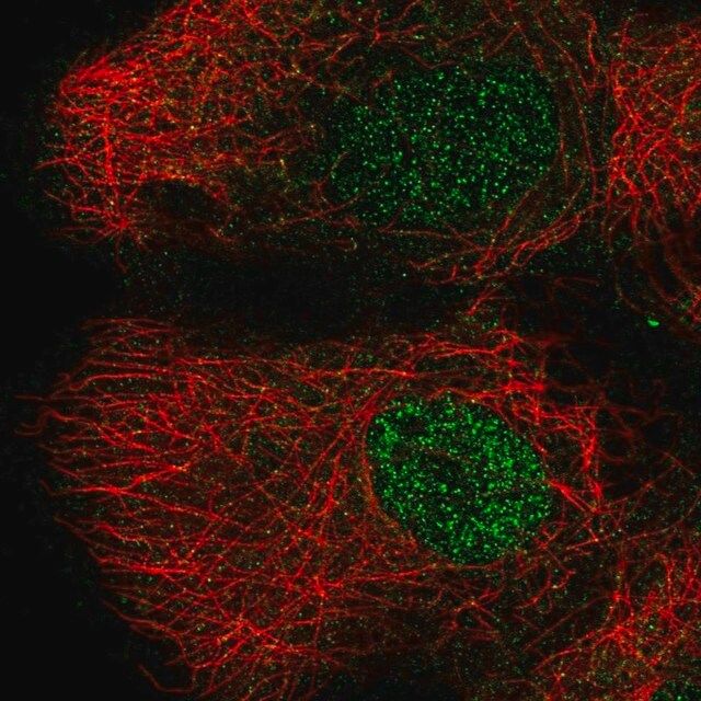 Anti-DLK2 antibody produced in rabbit