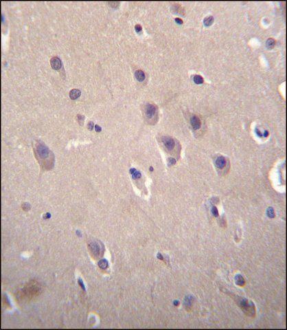 ANTI-DLL3 (C-TERM) antibody produced in rabbit