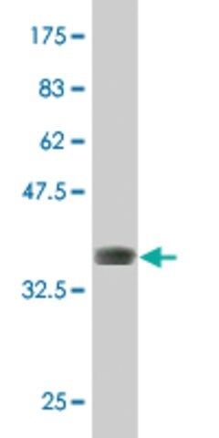 ANTI-DLX5 antibody produced in mouse