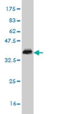 ANTI-DLX1 antibody produced in mouse