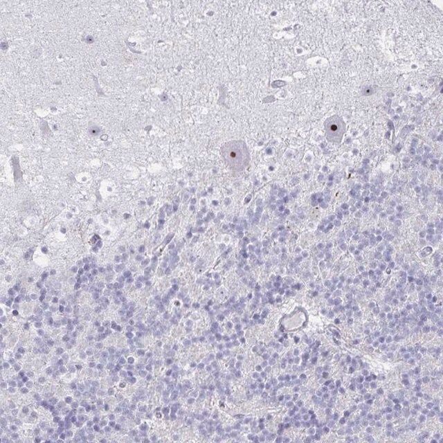 Anti-DLK2 antibody produced in rabbit