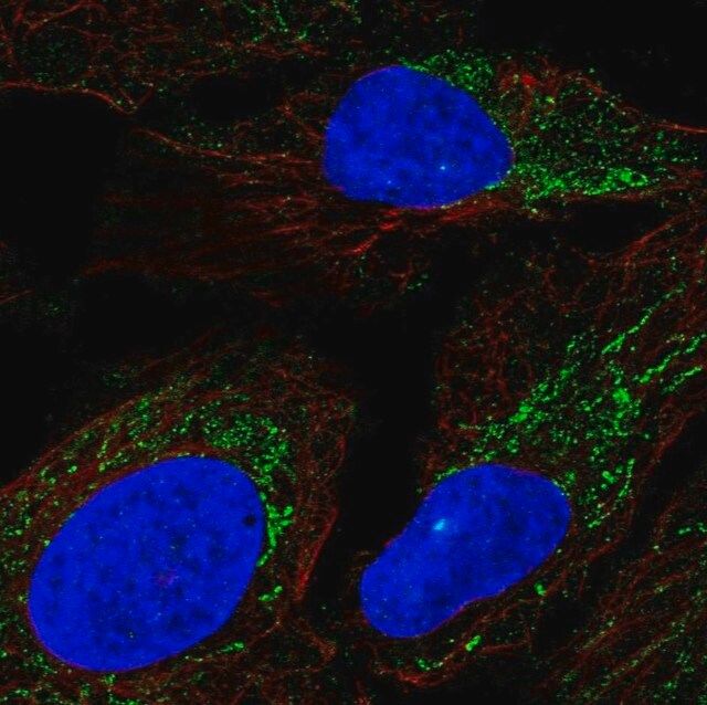 Anti-DMGDH antibody produced in rabbit