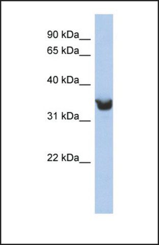 Anti-DLK1 antibody produced in rabbit