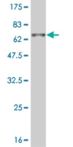 ANTI-DLX3 antibody produced in mouse