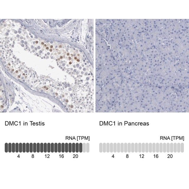 Anti-DMC1 antibody produced in rabbit