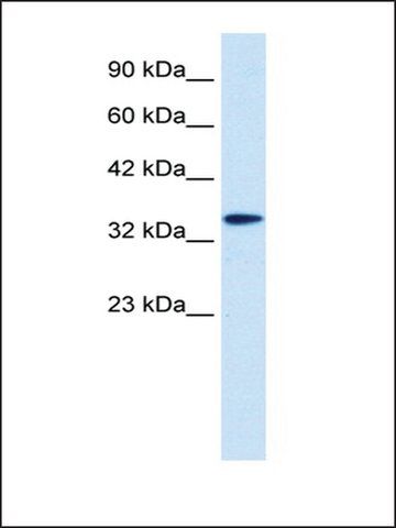 Anti-DLX6 antibody produced in rabbit